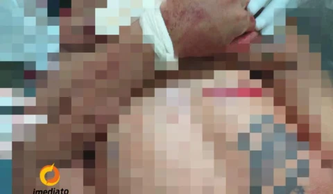 Um morre e outro fica ferido após serem alvejados por motoqueiro na Colônia Oliveira Machado