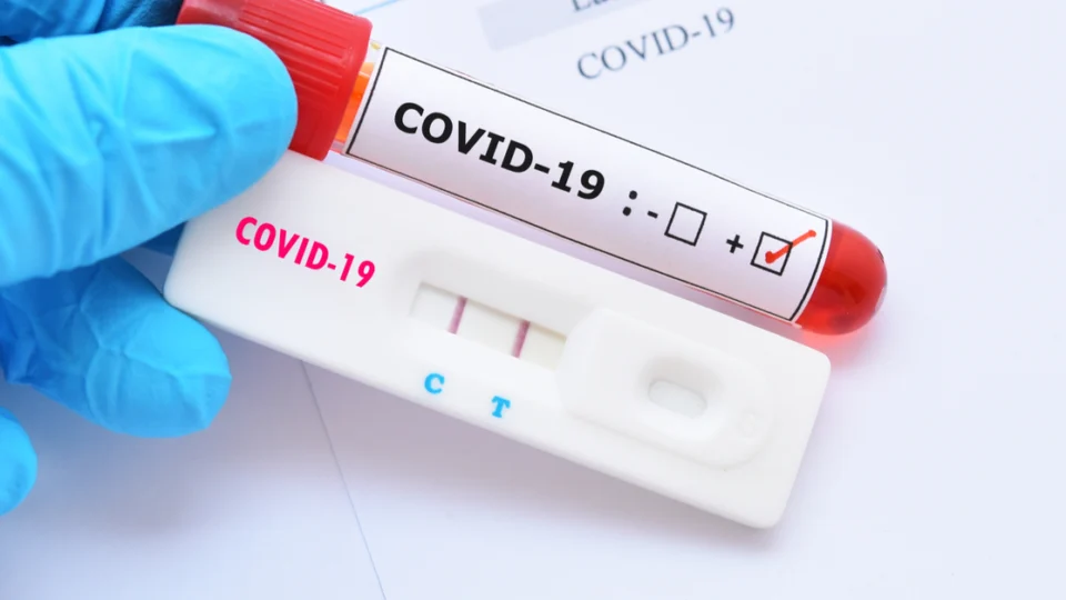 Planos de saúde são obrigados a cobrir teste rápido para covid-19 a partir desta segunda (29)