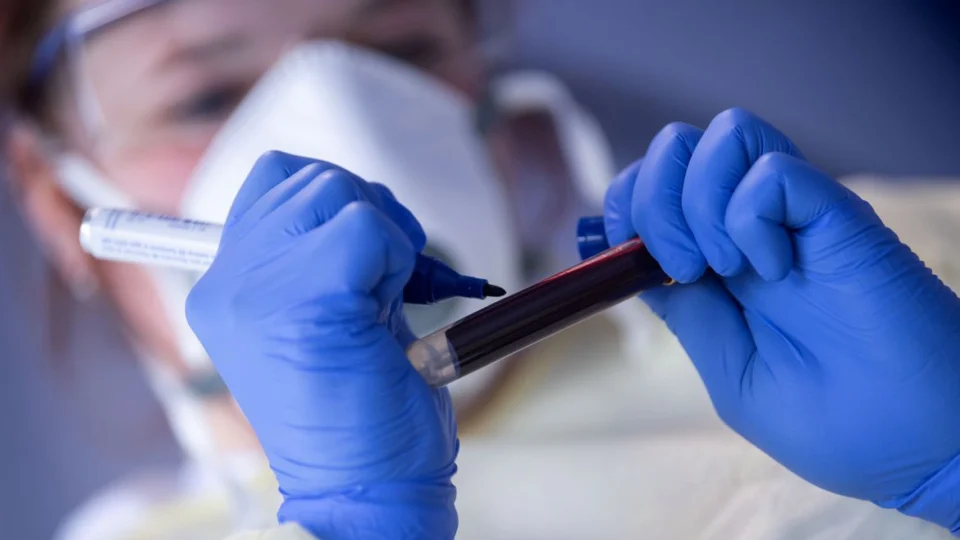 Nas últimas 24h, 421 novos casos de Covid-19 são registrados no AM