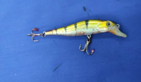 Criança passa por cirurgia delicada para retirada de anzol dos olhos