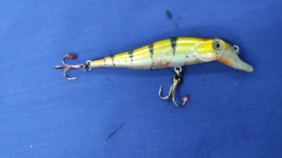 Criança passa por cirurgia delicada para retirada de anzol dos olhos