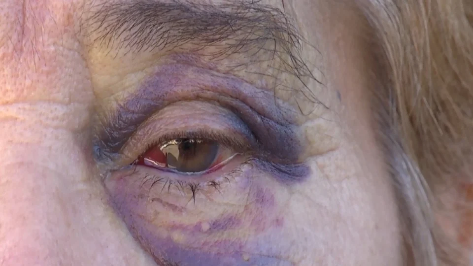 Polícia prende homem que agrediu idosa de 69 anos com uma barra de ferro em agência bancária