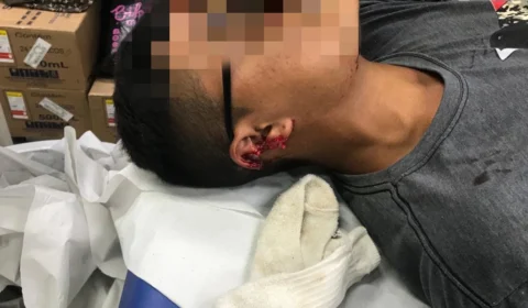 Jovem é atingido com tiro na orelha durante assalto no Nossa Senhora de Fátima