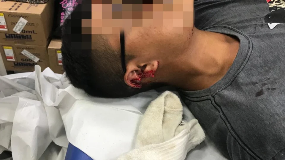 Jovem é atingido com tiro na orelha durante assalto no Nossa Senhora de Fátima