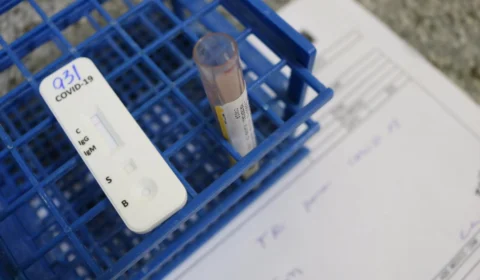 Pacientes oncológicos são testados para Covid-19 antes de cirurgias eletivas, na FCecon