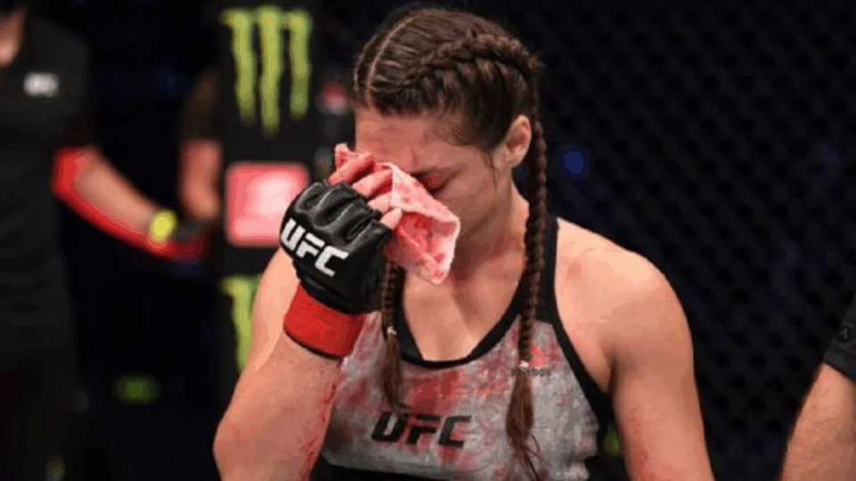 UFC 254: Liana Jojua tem nariz cortado ao meio após ‘chuva de cotoveladas’
