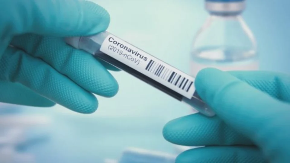 Covid-19: FVS-AM informa 789 novos casos da doença no Amazonas