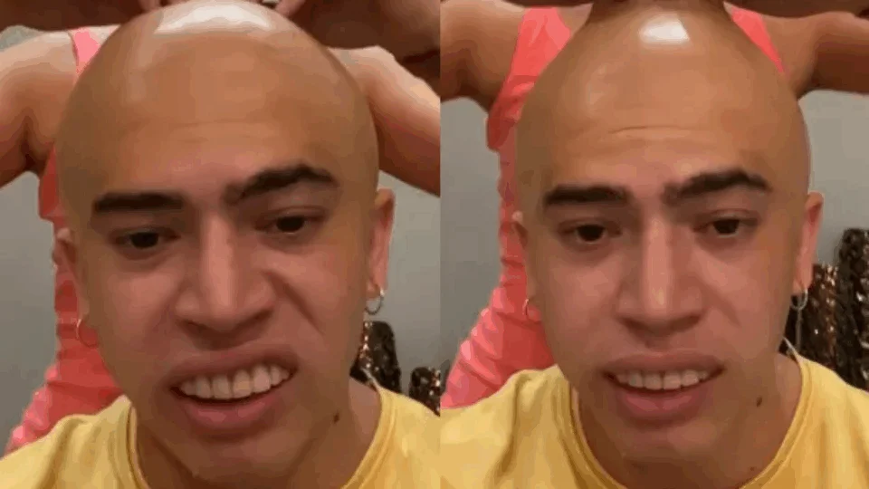 Whindersson Nunes dá susto em fãs ao aparecer “careca”