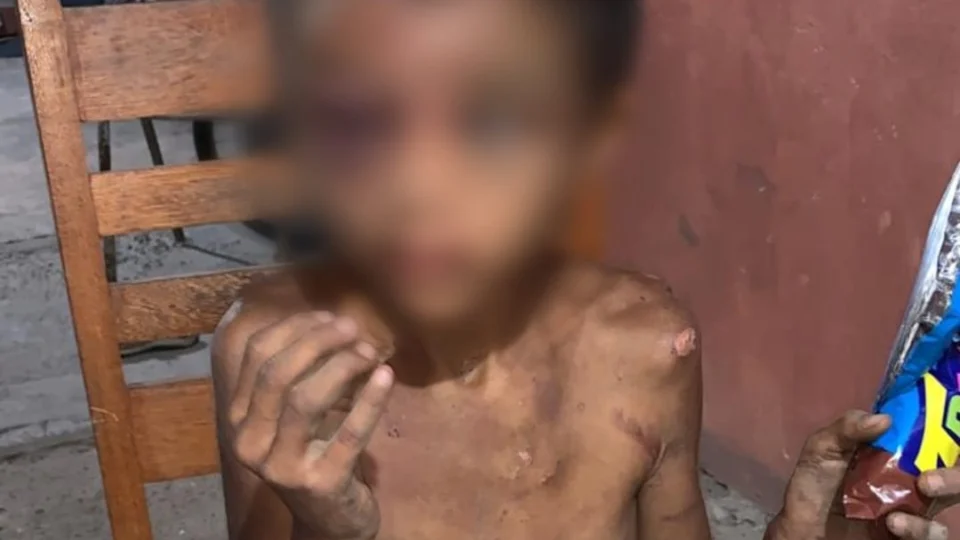 Menina de 9 anos, vítima de estupro, teria sido abusada sexualmente pelo próprio irmão