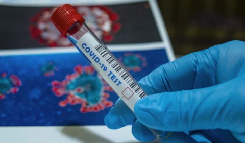 COVID-19 – Brasil registra menos de 20 mil mortes em um mês; Esta é a primeira vez desde abril