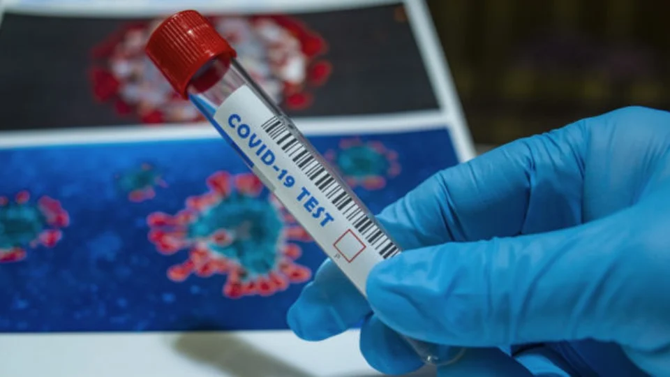 Boletim da FVS-AM informa 2.342 novos casos de Covid-19  no Amazonas