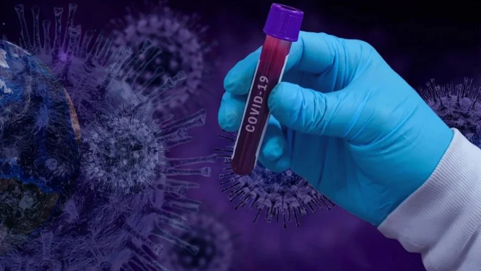 Situação da Covid-19 no Amazonas é atualizada pela FVS nesta segunda-feira (23/11)