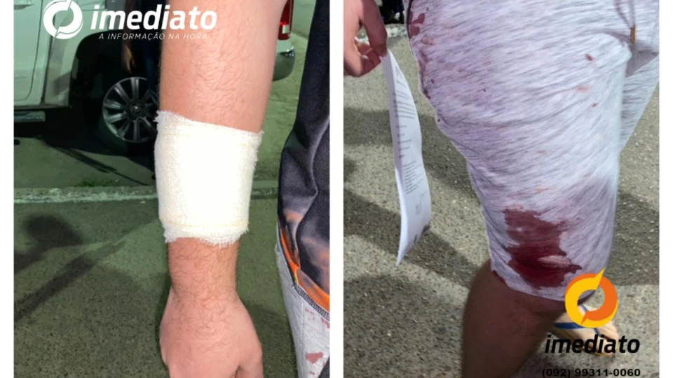 Motorista de App vai ajudar amigo que estava sendo supostamente assaltado, e acaba levando duas facadas