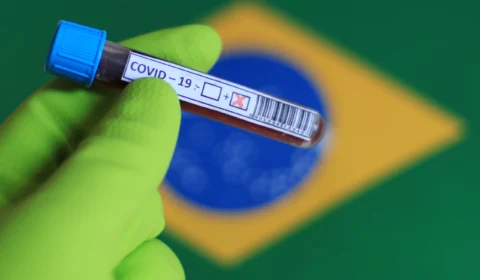 Boletim Covid-19: nas últimas 24 horas, 2.202 novos casos e 67 óbitos são registrados no Amazonas