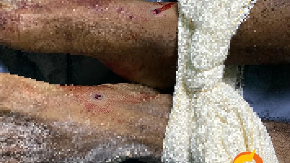 Entregador é torturado e corpo é jogado na Colônia Terra Nova – A vítima foi torturada