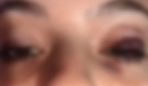 Veterinária é agredida pelo companheiro, denuncia na web e faz apelo: “Vai por mim. Denuncia.”