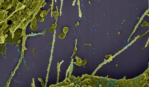 Pesquisadores identificam no Rio possível nova linhagem do coronavírus