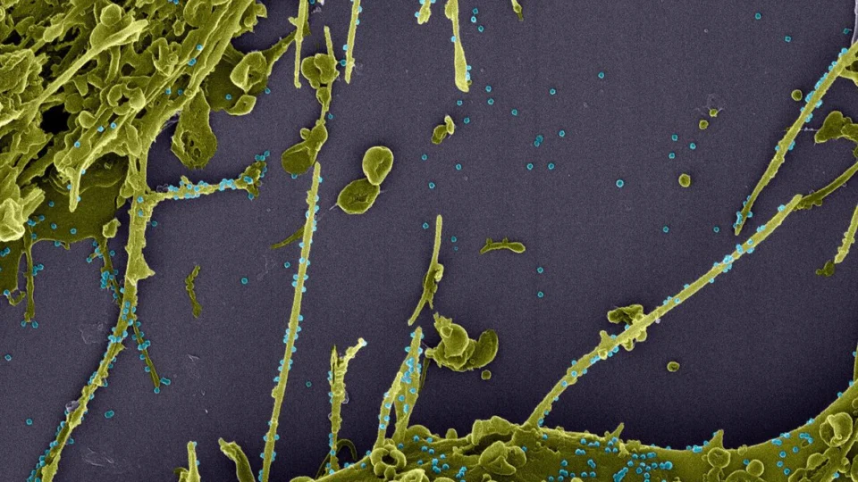 Pesquisadores identificam no Rio possível nova linhagem do coronavírus