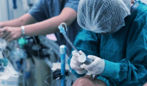 Médicos do interior do Amazonas receberão treinamento sobre intubação