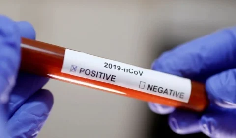 Defensoria pede à Justiça que Estado e Prefeitura de Manaus sejam obrigados a realizar testagem em massa