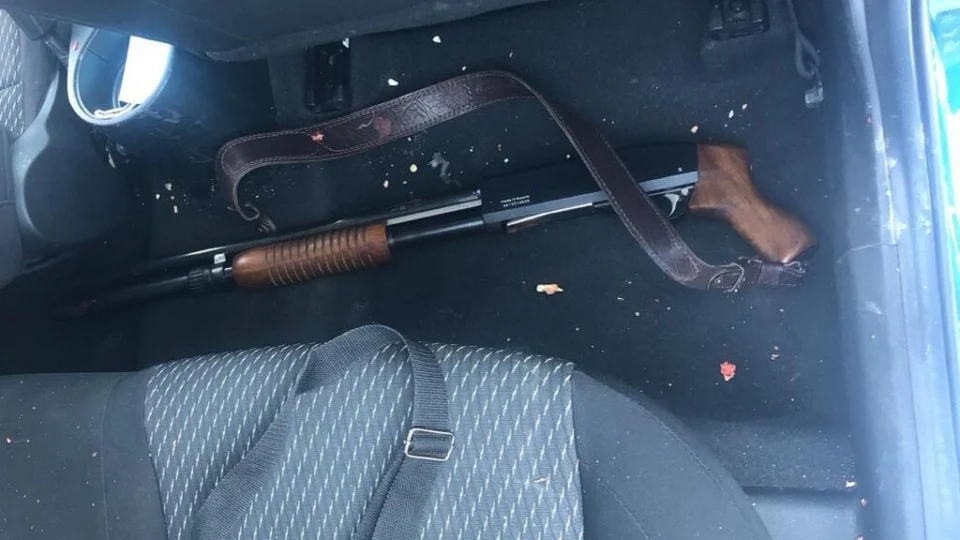 Veja vídeos inacreditáveis de como ficou homem que sobreviveu a tiro no rosto – Ele ficou completamente sem face