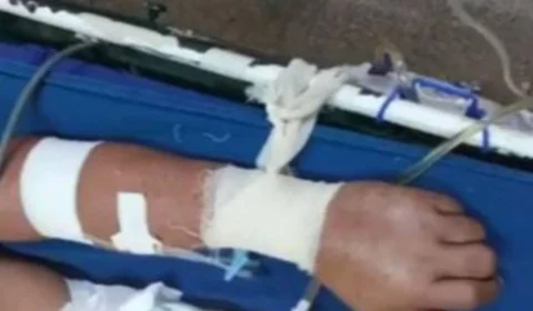 Por falta de sedativo, pacientes em estado grave estão sendo amarrados a macas em Parintins