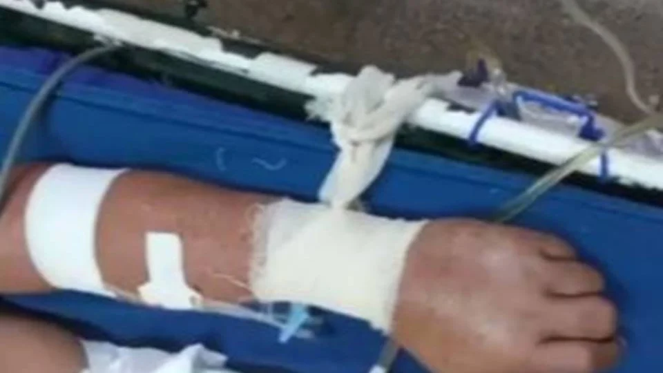 Por falta de sedativo, pacientes em estado grave estão sendo amarrados a macas em Parintins