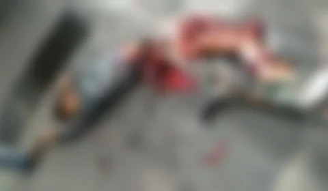 VÍDEO CHOCANTE! Veja como ficou homem que teve metade do corpo esmagado e sobreviveu