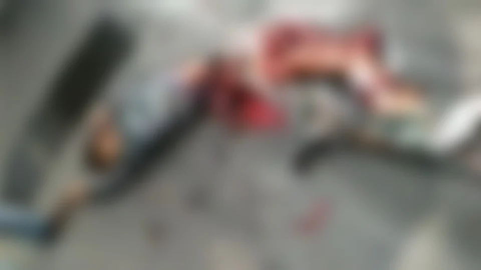 VÍDEO CHOCANTE! Veja como ficou homem que teve metade do corpo esmagado e sobreviveu