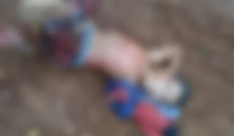 IMAGENS E VÍDEO CHOCANTES! Criança tem braço totalmente arrancado em acidente de moto