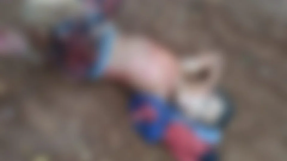 IMAGENS E VÍDEO CHOCANTES! Criança tem braço totalmente arrancado em acidente de moto