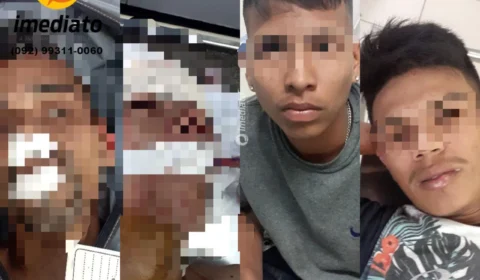 Vídeo mostra o momento em que baleados no Fátima 1 chegam no HPS Platão Araújo – Imagens fortes