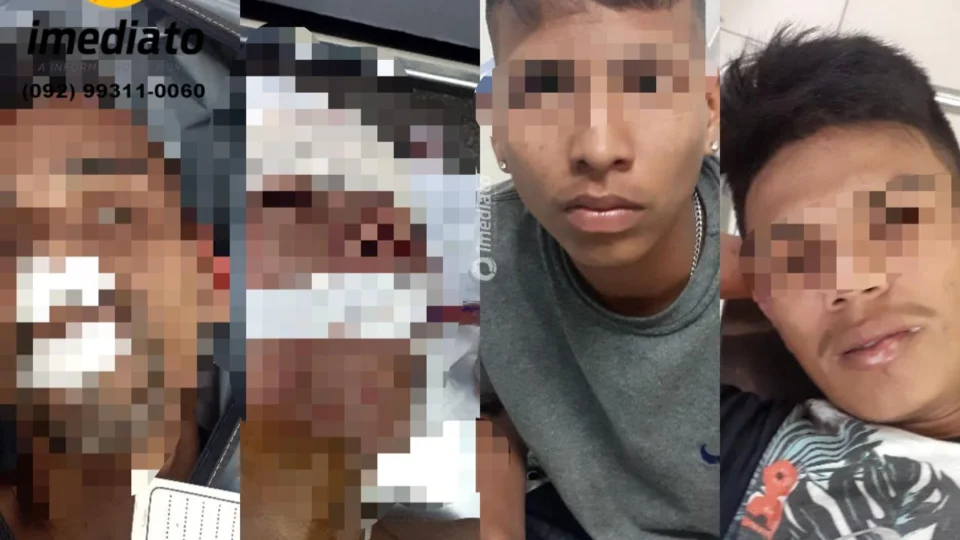 Vídeo mostra o momento em que baleados no Fátima 1 chegam no HPS Platão Araújo – Imagens fortes