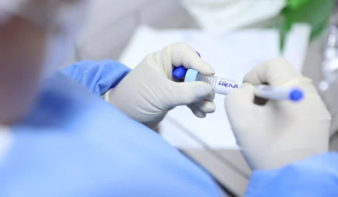 Governo do Amazonas intensifica testagem para Covid-19 na rede estadual