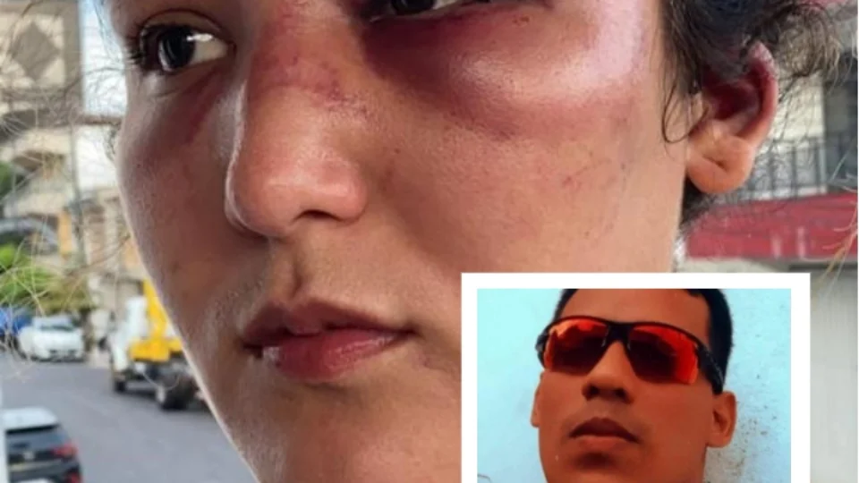 Após espancar a ex namorada, agressor se livra da prisão por expirar o período de flagrante, mas segue foragido