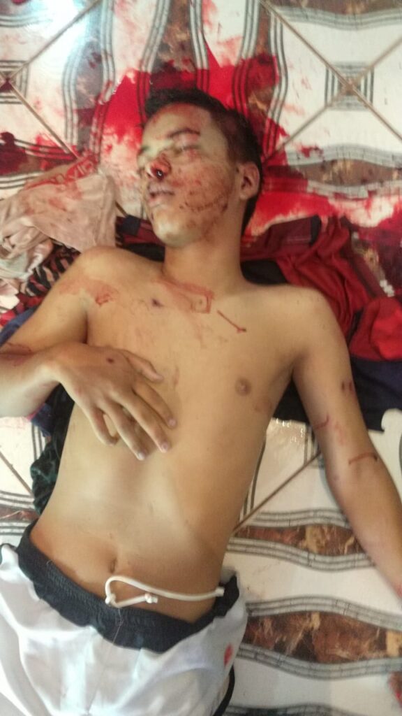 Adolescente é assassinado com 5 tiros dentro de casa por cobrança do tráfico de drogas na zona Leste.