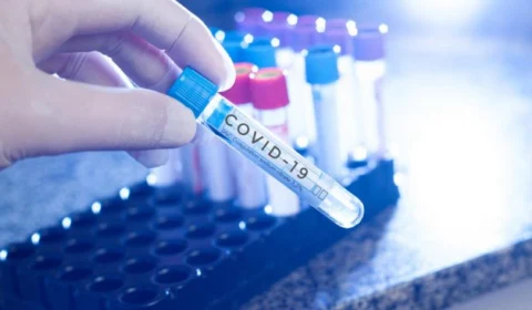 Boletim da FVS-AM informa 536 novos casos de Covid-19 nas últimas 24h