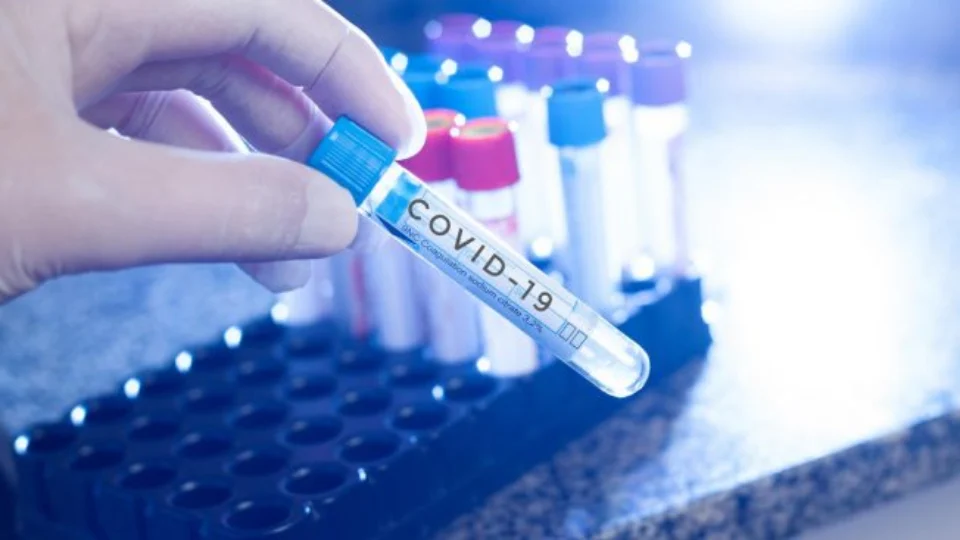 Amazonas teve 515 novos casos de Covid-19 registrados nas últimas 24h