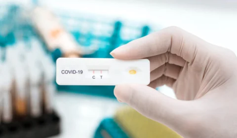 Boletim Covid-19 desta sexta-feira (23) informa 829 novos casos da doença no Amazonas