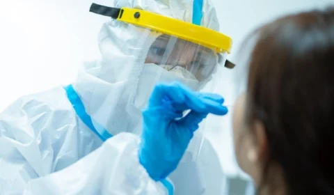 Por unanimidade, uso de autotestes de Covid-19 é aprovado no Brasil