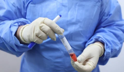 FVS-AM informa o registro de 507 novos casos de Covid-19 nas últimas 24h