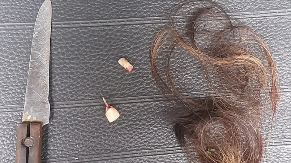 Mulher vítima de violência doméstica, é estuprada, tem dentes arrancados e cabelo raspado; Veja detalhes