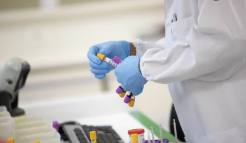 Casos de síndrome respiratória aguda grave devem crescer no país