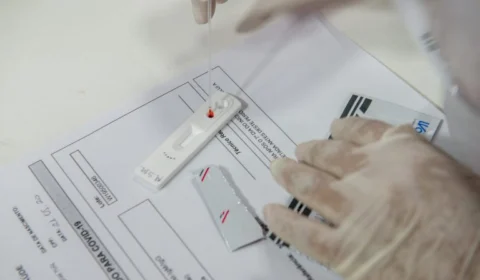 Boletim da FVS-AM informa o registro de 312 novos casos de Covid-19 nas últimas 24h