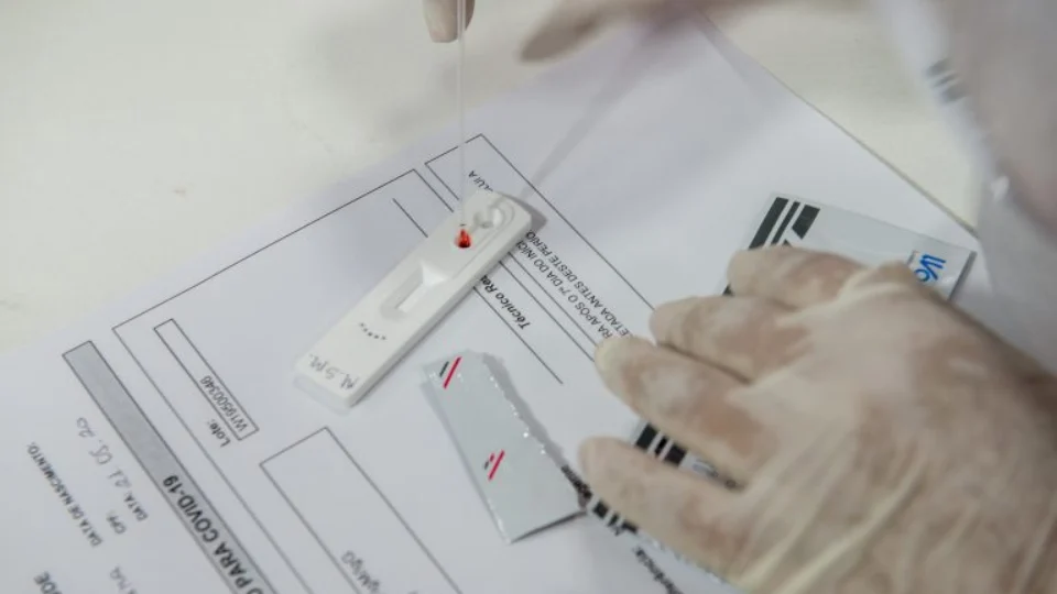 Boletim da FVS-AM informa o registro de 312 novos casos de Covid-19 nas últimas 24h