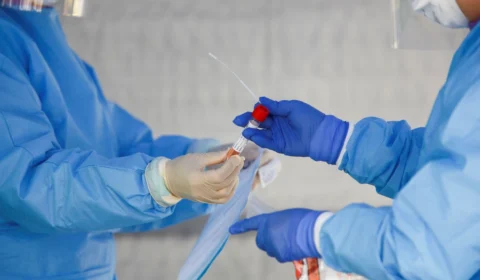 Autoridades do RJ estão monitorando moradores que tiveram contato com paciente infectado com variante indiana