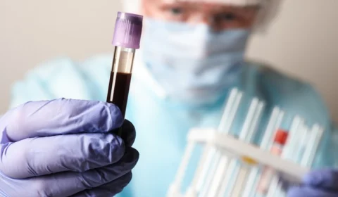 Amazonas tem 620 novos casos de Covid-19 nas últimas 24h