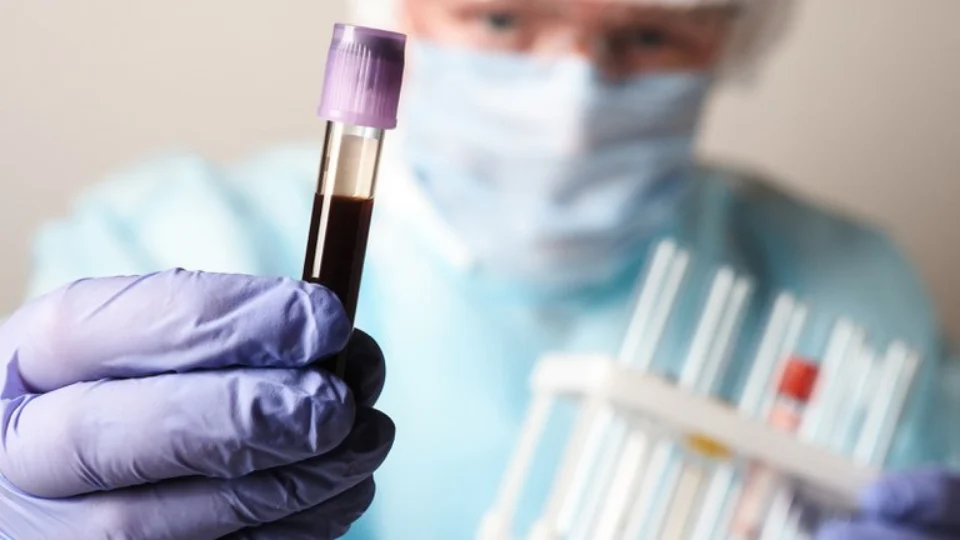 Amazonas tem 620 novos casos de Covid-19 nas últimas 24h