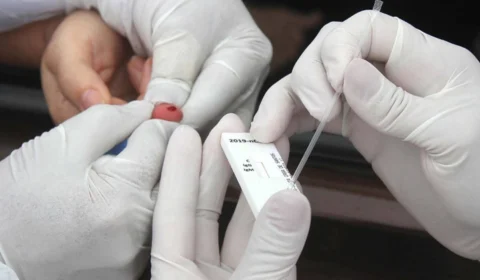 Uso de autotestes é reavaliado no Brasil na sexta-feira (28)