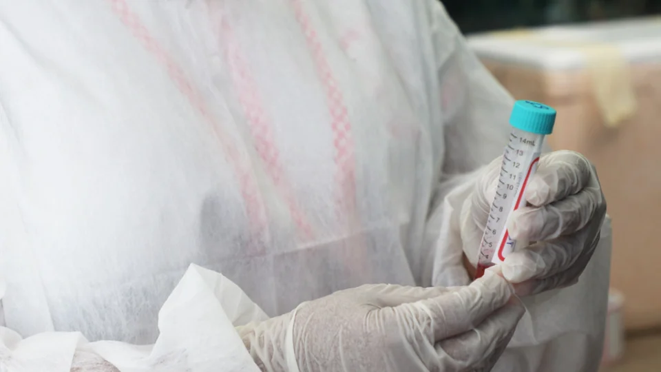 Boletim da FVS-AM informa o diagnóstico de 661 novos casos de Covid-19 nas últimas 24h